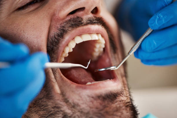 Best Oral Cancer Screening  in Keys, OK